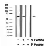 Phospho-IRF5 (Ser437) Antibody in Western Blot (WB)