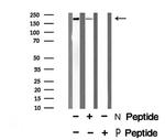 Phospho-MYLK (Tyr464) Antibody in Western Blot (WB)