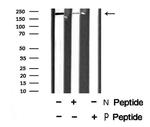 Phospho-MYLK (Tyr471) Antibody in Western Blot (WB)