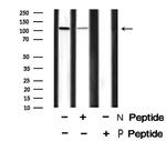 Phospho-EphA7 (Tyr608) Antibody in Western Blot (WB)