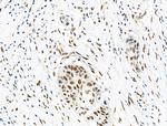 Phospho-eIF2 beta (Ser2) Antibody in Immunohistochemistry (Paraffin) (IHC (P))