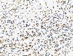 Phospho-eIF2 beta (Ser2) Antibody in Immunohistochemistry (Paraffin) (IHC (P))