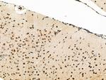 Phospho-eIF2 beta (Ser2) Antibody in Immunohistochemistry (Paraffin) (IHC (P))