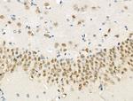 Phospho-eIF2 beta (Ser2) Antibody in Immunohistochemistry (Paraffin) (IHC (P))