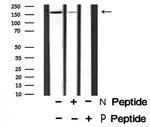 Phospho-FANCD2 (Ser717) Antibody in Western Blot (WB)