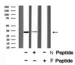 Phospho-NPM1 (Thr237) Antibody in Western Blot (WB)