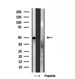 PADI2 Antibody in Western Blot (WB)