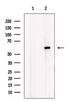 LPCAT1 Antibody in Western Blot (WB)