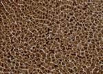 S100A14 Antibody in Immunohistochemistry (Paraffin) (IHC (P))