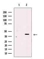 PRPH2 Antibody in Western Blot (WB)