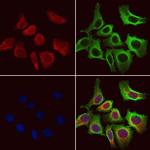 ACADVL Antibody in Immunocytochemistry (ICC/IF)