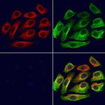 KIFC3 Antibody in Immunocytochemistry (ICC/IF)