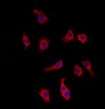 KIFC3 Antibody in Immunocytochemistry (ICC/IF)