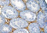 KIFC3 Antibody in Immunohistochemistry (Paraffin) (IHC (P))