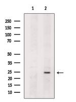 MAD2L2 Antibody in Western Blot (WB)