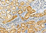 MLXIP Antibody in Immunohistochemistry (Paraffin) (IHC (P))