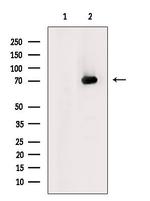 SLC22A12 Antibody in Western Blot (WB)