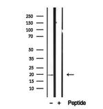 CPLX2 Antibody in Western Blot (WB)