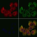 DCTN6 Antibody in Immunocytochemistry (ICC/IF)