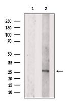 DCTN6 Antibody in Western Blot (WB)