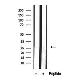 DCTN6 Antibody in Western Blot (WB)