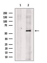 SLC13A2 Antibody in Western Blot (WB)