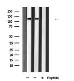 JMY Antibody in Western Blot (WB)