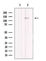 JMY Antibody in Western Blot (WB)