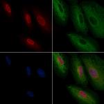 TEAD1 Antibody in Immunocytochemistry (ICC/IF)