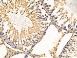 Cyclophilin F Antibody in Immunohistochemistry (Paraffin) (IHC (P))