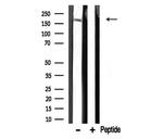 TRAP220 Antibody in Western Blot (WB)