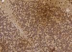 IP6K3 Antibody in Immunohistochemistry (Paraffin) (IHC (P))