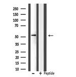 IP6K3 Antibody in Western Blot (WB)