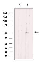 IP6K3 Antibody in Western Blot (WB)