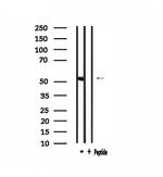 IP6K3 Antibody in Western Blot (WB)