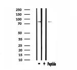 CDH18 Antibody in Western Blot (WB)