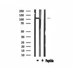 COL6A2 Antibody in Western Blot (WB)