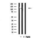 COL6A2 Antibody in Western Blot (WB)