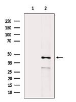 AGPAT5 Antibody in Western Blot (WB)