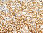 MRPL11 Antibody in Immunohistochemistry (Paraffin) (IHC (P))