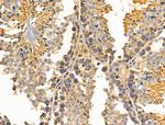 MRPL11 Antibody in Immunohistochemistry (Paraffin) (IHC (P))