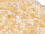 MRPL11 Antibody in Immunohistochemistry (Paraffin) (IHC (P))