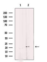 MRPL11 Antibody in Western Blot (WB)