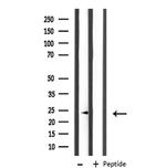 MRPL11 Antibody in Western Blot (WB)