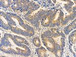 BST-1 Antibody in Immunohistochemistry (Paraffin) (IHC (P))