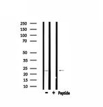 ARF4 Antibody in Western Blot (WB)