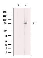 Calpain 10 Antibody in Western Blot (WB)