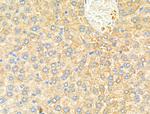 ME1 Antibody in Immunohistochemistry (Paraffin) (IHC (P))