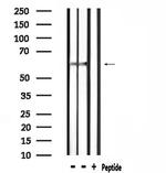 SLC9A8 Antibody in Western Blot (WB)