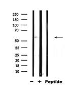 TCF4/TCF12 Antibody in Western Blot (WB)